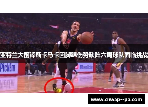 亚特兰大前锋斯卡马卡因脚踝伤势缺阵六周球队面临挑战